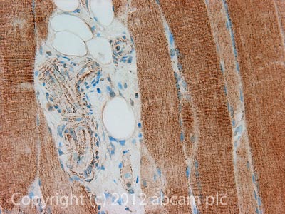 IHC image of GOT2 staining in Human normal skeletal muscle formalin fixed paraffin embedded tissue section, performed on a Leica BondTM system using the standard protocol F. The section was pre-treated using heat mediated antigen retrieval with sodium citrate buffer (pH6, epitope retrieval solution 1) for 20 mins. The section was then incubated with ab93928, 1/200 dilution, for 15 mins at room temperature and detected using an HRP conjugated compact polymer system. DAB was used as the chromogen. The section was then counterstained with haematoxylin and mounted with DPX.For other IHC staining systems (automated and non-automated) customers should optimize variable parameters such as antigen retrieval conditions, primary antibody concentration and antibody incubation times.