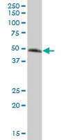 Anti-GPA33 antibody (ab67102) at 1/500 dilution + human colon tissue lysate at 25 µg/mlSecondaryGoat Anti-Mouse IgG (H&L)-HRP Conjugate at 1/2500 dilution