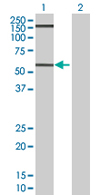 All lanes : Anti-GPA33 antibody (ab67102) at 1/500 dilutionLane 1 : GPA33 transfected 293T cell lysateLane 2 : Non transfected 293T cell lysateLysates/proteins at 25 µg/ml per lane.SecondaryGoat Anti-Mouse IgG (H&L)-HRP Conjugate at 1/2500 dilution