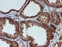 ab128534, at 1/150 dilution, staining CRYZL1 in paraffin-embedded Human prostate tissue by Immunohistochemistry.