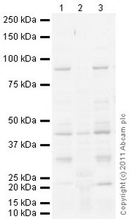 All lanes : Anti-GPCR GPR14 antibody (ab78449) at 1 µg/mlLane 1 : Heart (Mouse) Tissue Lysate Lane 2 : Eye (Mouse) Whole Cell Lysate - normal tissue (ab4029)Lane 3 : Heart (Rat) Tissue Lysate Lysates/proteins at 10 µg per lane.SecondaryGoat Anti-Rabbit IgG H&L (HRP) preadsorbed (ab97080) at 1/5000 dilutiondeveloped using the ECL techniquePerformed under reducing conditions.