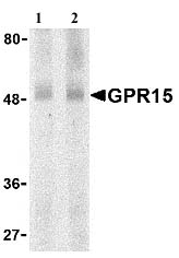 Lane 1 :  Anti-GPCR GPR15 antibody (ab8104) at 0.5 µg/mlLane 2 :  Anti-GPCR GPR15 antibody (ab8104) at 1 µg/mlLane 1 : Human spleen lysateLane 2 : Human spleen lysateObserved band size : 50 kDa (why is the actual band size different from the predicted?)