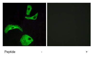 Immunofluorescence analysis of HeLa cells using ab76258 at a 1/500 dilution.Left image un-treated.Right image treated with immunizing peptide.