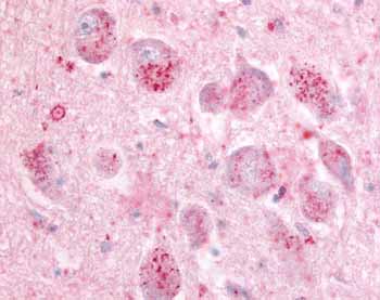 ab60832, at 10&microg/ml, staining human GPR21 in brain tissue. Formalin-fixed paraffin-embedded tissue.