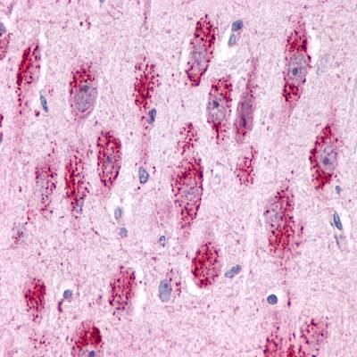 Ab12561 staining neuronal brain tissue and glia.