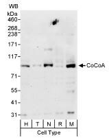 All lanes : Anti-CoCoA antibody (ab70564) at 0.4 µg/mlLane 1 : HeLa whole cell lysateLane 2 : 293T whole cell lysateLane 3 : NIH3T3 whole cell lysateLane 4 : Ramos whole cell lysateLane 5 : MCF7 whole cell lysateLysates/proteins at 50 µg per lane.developed using the ECL technique