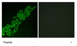 Left panel: immunofluorescence analysis of A549 cells using ab79516 at a 1/500 dilution. Right panel: same, after pre-incubation with the immunizing peptide.