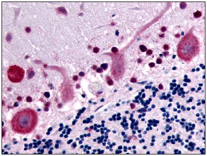 ab61429, at 10µg/ml, staining human GPR32 in brain cerebellum, using Immunohistochemistry, Formalin/PFA fixed Paraffin embedded tissue.