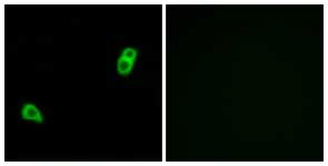 Immunofluorescence analysis of LOVO cells labelling GPCR GPR34 with ab134811 at 1/100. Right panel represents cells treated with the synthesized peptide.
