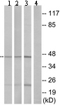 All lanes : Anti-GPCR GPR34 antibody (ab134811) at 1/500 dilutionLane 1 : HT-29 cell extractLane 2 : K562 cell extractLane 3 : COS7 cell extractLane 4 : HT-29 cell extract treated with the synthesized peptide