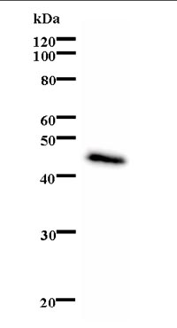 Anti-CSB antibody [553C5a] (ab66598) + immunising recombinant protein