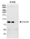 Detection of human CoCoA by Immunoprecipitation in whole cell lysate from MCF7 cells (1 mg, 20% of immunoprecipitate loaded/lane), using ab70564 at 3 µg/mg of lysate (lane 2). CoCoA was also immunoprecipitated using another CoCoA antibody (ab70563) which recognizes an upstream epitope (lane 1). Lane 3: Control IgG immunoprecipitate. Subsequent blotting of immunoprecipitate for the detection of CoCoA was performed using 1µg/ml of ab70564 and 50µg of lysate. Detection was by chemiluminescence with an exposure time of 30 seconds.