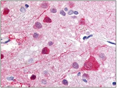 ab61423, at 2.5µg/ml, staining human GPCR GPR52 in brain, using Immunohistochemistry, Formalin/PFA fixed Paraffin embedded tissue.
