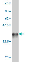 Western blot against tagged recombinant protein immunogen using ab57519 GPCR LGR7 antibody at 1ug/ml.