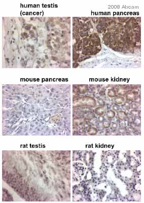 ab38089 staining pancreas (human and mouse) kidney (mouse and rat) and testis (rat and human) tissue sections by IHC-P.  Sections were formaldehyde fixed and subjected to heat mediated antigen retrieval in citrate buffer (pH 6) prior to blocking in sequential (prediluted) peroxidase and protein block for 20 minutes at 20°C.  The primary antibody was diluted 1/100 and incubated with the samples for 45 minutes at 20°C.  A HRP-conjugated goat anti-rabbit anitbody was used as the secondary.See Abreview