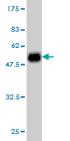 Western blot against tagged recombinant protein immunogen using ab57203 CSEN antibody at 1ug/ml.