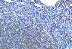 Immunohistochemistry on paraffin sections of human spleen.