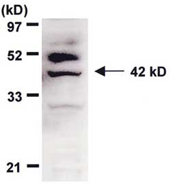 After retroviral transduction, CCR10-B16 cells were lysed, and CCR10 was detected by Western blotting after gel electrophoresis. A single band representing CCR10 was detected at 42 kD.