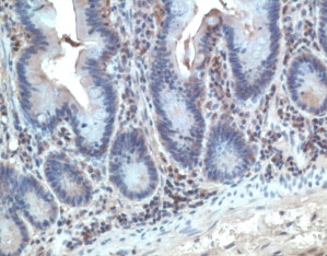 ab3904, at a dilution of 1/250, staining CCR10 in human tonsil section by Immunohistochemistry (Formalin/PFA-fixed paraffin-embedded sections).
