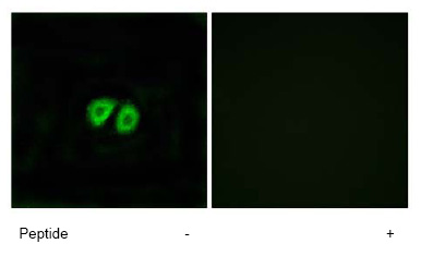 Immunofluorescence analysis of MCF-7 cells using 1/500 - 1/1000 ab77515 Left image: untreated.Right image: after pre-incubation twith immunizing peptide.