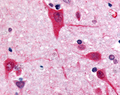 ab60984, at a concentration of 10µg/ml, staining GPCR GPR61 in formalin fixed paraffin embedded human brain cortex tissue sections by Immunohistochemistry.