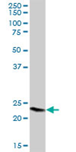 Anti-GPX8 antibody (ab72722) at 1/500 dilution + human kidney tissue lysate at 25 µgSecondaryGoat anti-mouse IgG (H&L)-HRP conjugate at 1/2500 dilution