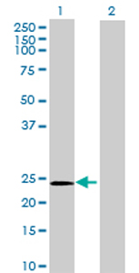 All lanes : Anti-GPX8 antibody (ab72722) at 1/500 dilutionLane 1 : GPX8 transfected 293T cell lysateLane 2 : Non-transfected 293T cell lysateLysates/proteins at 25 µg per lane.SecondaryGoat anti-mouse IgG (H&L)-HRP conjugate at 1/2500 dilution