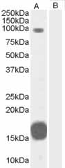 All lanes : Anti-GRAF antibody (ab15916) at 0.3 µg/mlLane 1 : (A) Human Heart lysateLane 2 : (B) Human Heart lysate with immunizing peptideLysates/proteins at 35 µg per lane.