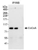 Detection of human CoCoA by Immunoprecipitation in whole cell lysate from MCF7 cells (1 mg, 20% of immunoprecipitate loaded/lane), using ab70563 at 3 µg/mg of lysate (lane 1). CoCoA was also immunoprecipitated using another CoCoA antibody (ab70564) which recognizes a downstream epitope (lane 2). Lane 3: Control IgG immunoprecipitate. Subsequent blotting of immunoprecipitate for the detection of CoCoA was performed using 1µg/ml of the other antibody (ab70564) and 50µg of lysate. Detection was by chemiluminescence with an exposure time of 30 seconds.