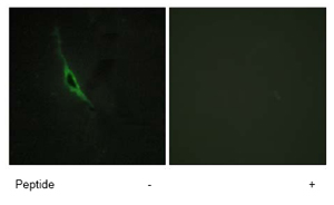 Immunofluorescence analysis of NIH/3T3 cells using ab69884 at 1/500 dilution in the presence or absence of the immunising peptide.