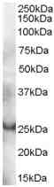 Anti-GRAP antibody (ab9703) at 0.3 µg/ml + Human Thymus lysate (35µg protein in RIPA buffer).