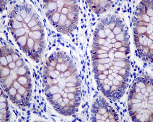 Immunohistochemical analysis of formalin-fixed, paraffin-embedded Human colon tissue, labeling GRASP65 with ab174834 at 1/50 dilution.