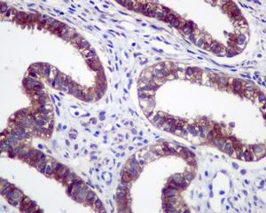Immunohistochemical analysis of formalin-fixed, paraffin-embedded Human uterus tissue, labeling GRASP65 with ab174834 at 1/50 dilution.