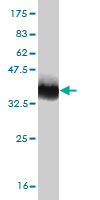 Western blot against tagged recombinant protein immunogen using ab55153 GRB 10 antibody at 1ug/ml.