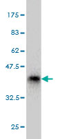 Anti-GRC5 / PHF2 antibody (ab55619) at 5 µg/ml + 0.2 µg/lane of partial recombinant GRC5 / PHF2 protein with a tagSecondaryGoat anti mouse IgG (H&L)-HRP conjugate at 1/5000 dilution