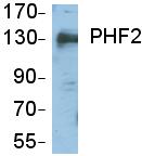 Anti-GRC5 / PHF2 antibody - Carboxyterminal end (ab65771) at 1/1000 dilution + Nuclear extracts of HeLa cells.