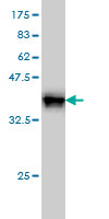 Western blot against tagged recombinant protein immunogen using ab55157 GRF2 antibody at 1ug/ml.