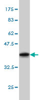 Western blot against tagged recombinant protein immunogen using ab57928 GRK1 antibody at 1ug/ml.
