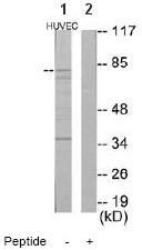 All lanes : Anti-GRK2 antibody (ab64858) at 1/500 dilutionLane 1 : Extracts from HuvEc cellsLane 2 : Extracts from HuvEc cells with immunising peptide