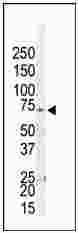 Anti-GRK4 antibody (ab38293) at 1/100 dilution + HL60 cell lysate