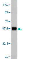 Western blot against tagged recombinant protein immunogen using ab55139 GRK4 antibody at 1ug/ml.