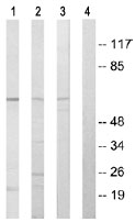 All lanes : Anti-GRK6 antibody (ab64915) at 1/500 dilutionLane 1 : Extracts from Jurkat cellsLane 2 : Extracts from COLO205 cellsLane 3 : Extracts from HUVEC cellsLane 4 : Extracts from HUVEC cells with immunising peptide at 10 µgLysates/proteins at 30 µg per lane.
