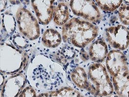 ab123965, at 1/50 dilution, staining Growth Arrest Specific Protein 7 in paraffin-embedded Human kidney tissue by Immunohistochemistry.
