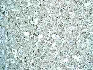 Immunohistochemical analysis of paraffin-embedded Human brain tissue labeling Growth Arrest Specific Protein 7 with ab168370 at 1/100 dilution.