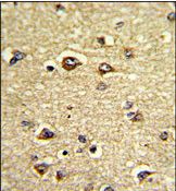 Immunohistochemical analysis of formalin fixed and paraffin embedded Human brain tissue labelling Growth Arrest Specific Protein 7 with ab135591 at a 1/50 dilution, followed by peroxidase conjugation of the secondary antibody and DAB staining.