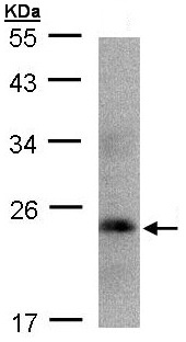 Anti-Growth Hormone antibody (ab109759) at 1/1000 dilution + 293T cell lysate at 30 µg