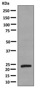 Anti-Growth Hormone antibody [EPR11047(B)] (ab155276) at 1/1000 dilution + Human placenta lysate at 10 µg