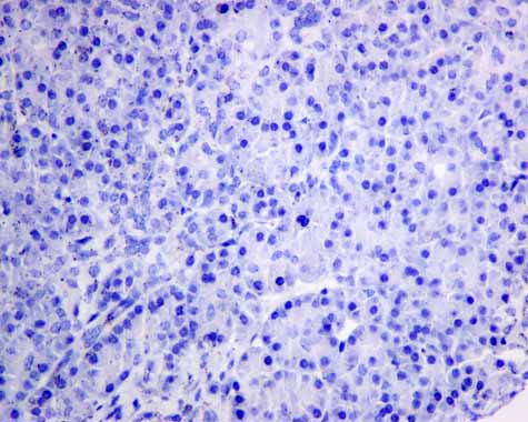 ab157456 showing -ve staining in Human normal pancreas.