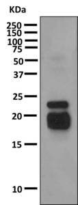 Anti-Growth Hormone antibody [EPR9524] (ab155974) at 1/1000 dilution + Human pituitary lysate at 10 µgSecondaryHRP labeled goat anti-rabbit IgG at 1/2000 dilution