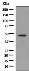 Anti-Growth Hormone antibody [EPR9524] (ab155974) at 1/1000 dilution + Human Growth Hormone recombinant protein with proprietary tag at 0.01 µgSecondaryHRP labeled goat anti-rabbit IgG at 1/2000 dilution